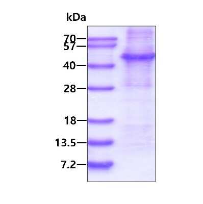 SDS-PAGE: Recombinant Human AFAP His Protein [NBP2-51706]